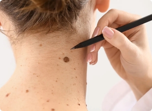 DermoSURG : Le 1er r&eacute;seau lyonnais d&eacute;di&eacute; &agrave; la chirurgie dermatologique