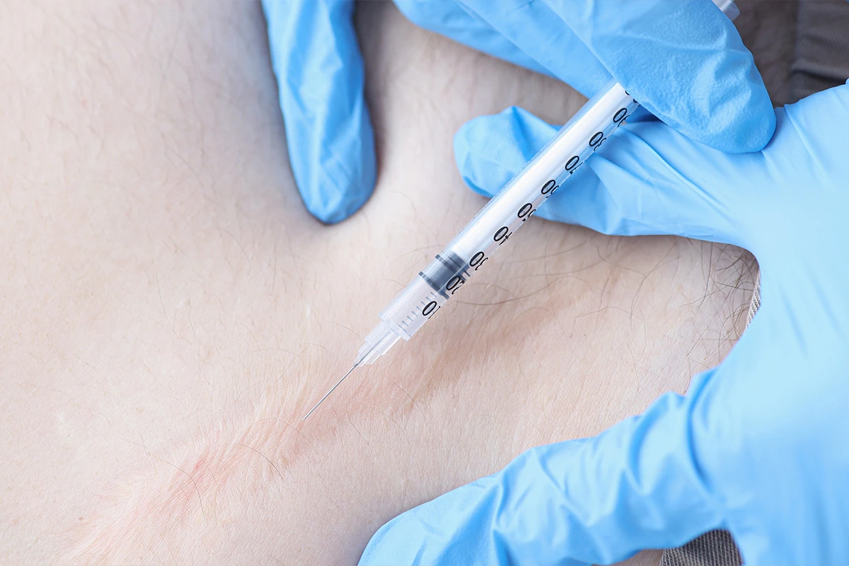 traitement cicatrice ch&eacute;lo&iuml;de